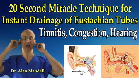 20 Second Miracle Technique For Instant Drainage Of Eustachian Tubes