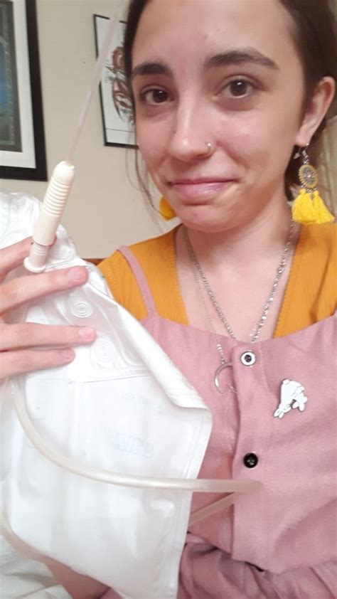 Catheters And Me A True Story From 21 Year Old Gemma Bladder And Bowel