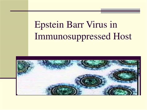 Ppt Epstein Barr Virus In Immunosuppressed Host Powerpoint