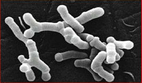 Bifidobacterium Longum Beneficios Con Base Científica Salud Y Belleza