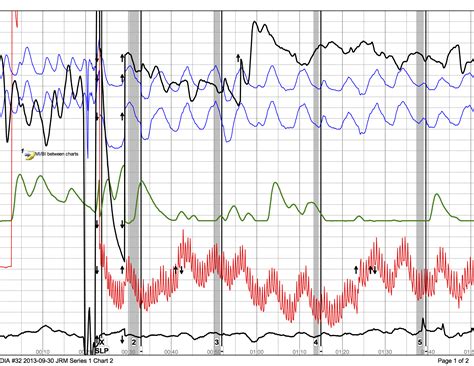 What Are You Measuring During Polygraph Test Premier Polygraph Services