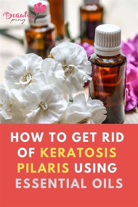 How To Get Rid Of Keratosis Pilaris Using Essential Oils Essential