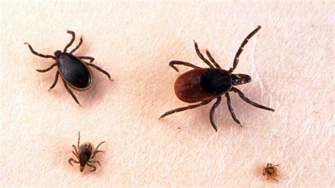 Rare Potentially Deadly Tick Borne Disease Powassan Found In New York