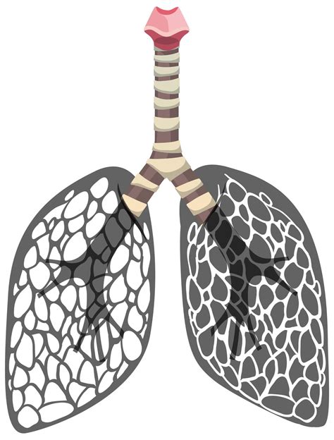 Lungs Cancer Icon Isolated On White Background 1541134 Vector Art At