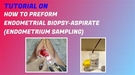 Endometrial Biopsy Aspirate Endometrium Sampling Procedure Youtube