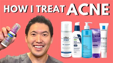 How I Treat Acne An Overview Of Treatment Options Youtube