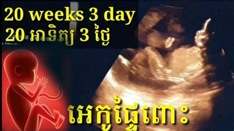 អេកូផ្ទៃពោះ 20 អាទិត្យ 3 ថ្ងៃ Pregnancy Ultrasound 20 Weeks 3 Day By Dr