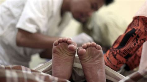 Germany Rules Circumcision Bodily Harm Ctv News