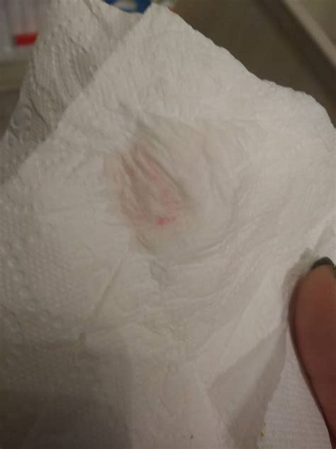1 Week Pregnancy Implantation Bleeding On Toilet Paper