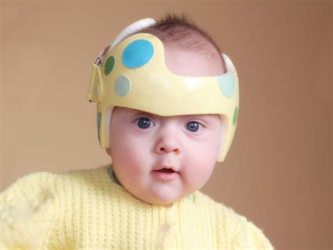 Plagiocephaly And Chiropractic Kelowna Pregnancy Chiropractor