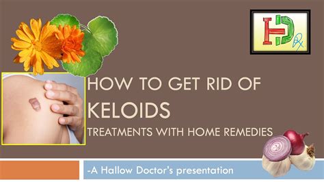 How To Get Rid Of Keloids Treatments With Home Remedies Natural Remedy