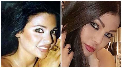 فنانات قبل وبعد عمليات التجميل. هل خضعت هيفاء وهبي لمزيد من عمليات التجميل؟ - مجلة هي