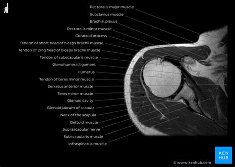 Radiological Anatomy X Ray Ct Mri Kenhub