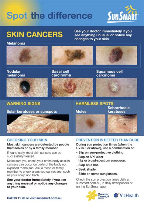 Skin Checks And Mole Removal Cranbourne And Croydon Healthmint