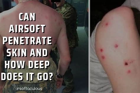 Can Airsoft Penetrate Skin And How Deep Does It Go Airsoftaculous