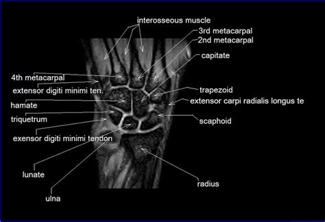 Flexion of great toe at metatarsophalangeal & interphalangeal joints inversion of foot plantar flexion. MRI wrist coronal anatomy | wrist tendon and ligaments ...