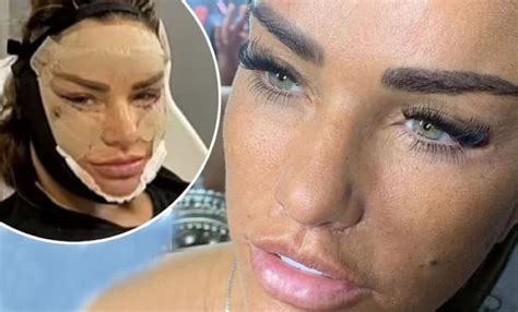 Katie Price Botched Before Plastic Surgery Photos Revealed