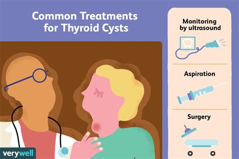 Cyst On Thyroid