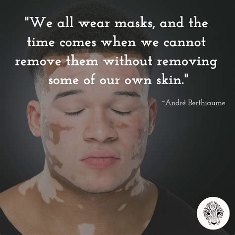 Zanderm Vitiligo Concealer Vitiligo Body Confidence Positive Body Image