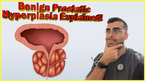 Benign Prostatic Hyperplasia BPH Explained By A Registered Nurse Men S Health Movember YouTube