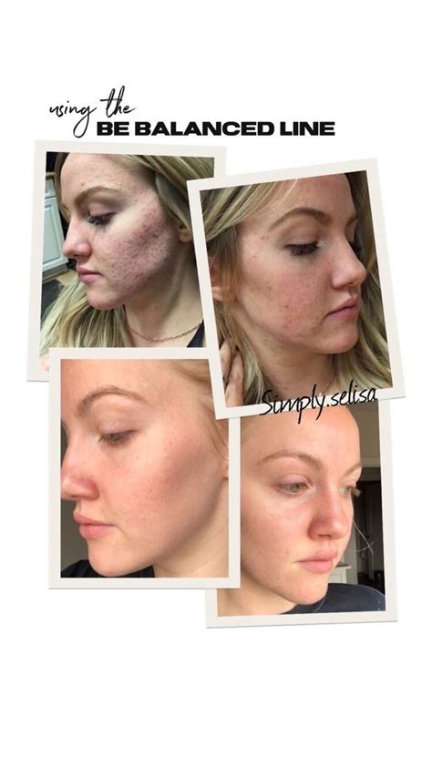 Pin On Monat Skin Care Products
