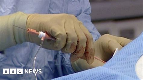 Heart Surgery Outside Wales Helped Cut Waiting Lists Bbc News