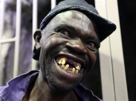 The Worlds Ugliest Man Of 2015 8 Pics