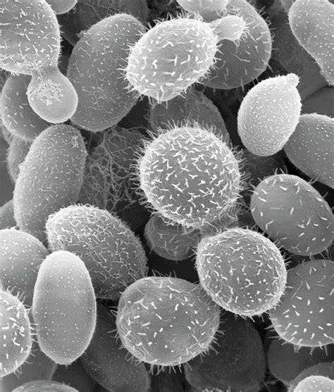 Yeast Fungus Cryptococcus Festucosus Photograph By Dennis Kunkel