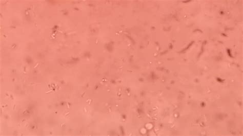 Listeria Monocytogenes Tumbling Motility Under Microscope Youtube