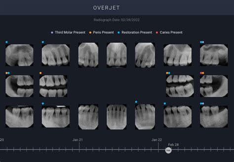 One Click Access To Images From Dentrix Eaglesoft And Open Dental