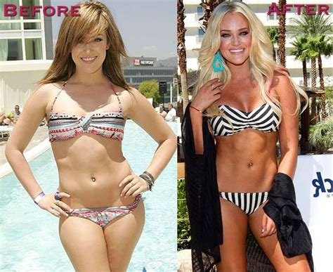 Lacey Schwimmer From Dancing With The Stars Plastic Surgery Dancing With The Stars Celebrities