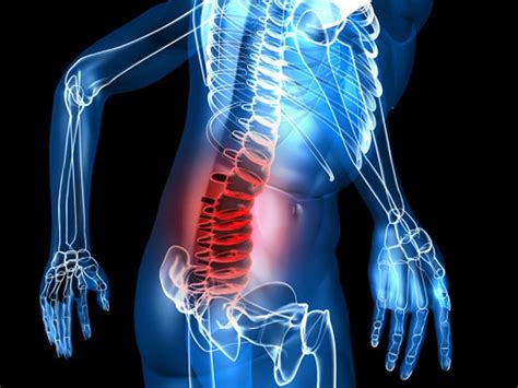 Oxycodonenaloxone An Adf Option For Chronic Low Back Pain