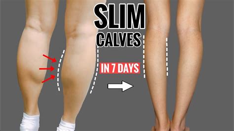 Fat Calves Skinny Body