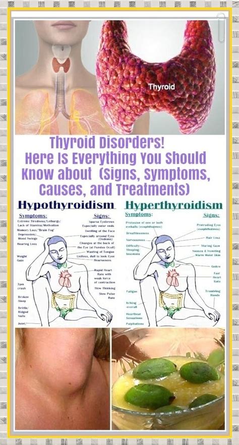 Here Is Everything You Should Know About Thyroid Disorders Signs