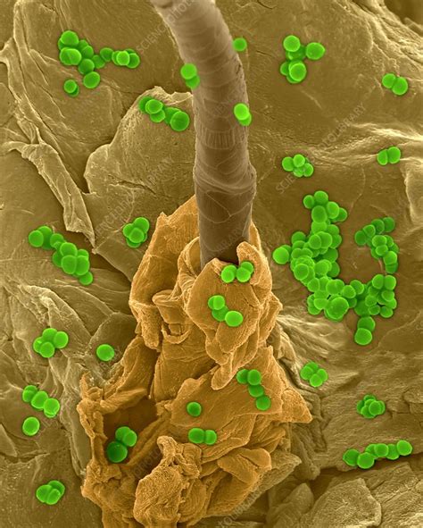 Staphylococcus Aureus On Human Skin Sem Stock Image C0321929