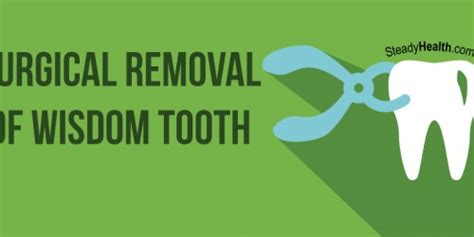 Non Surgical Removal Of Wisdom Tooth What To Expect And Aftercare Tips