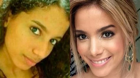 Anitta Antes E Depois Da Fama Veja As Mudanças Da Cantora
