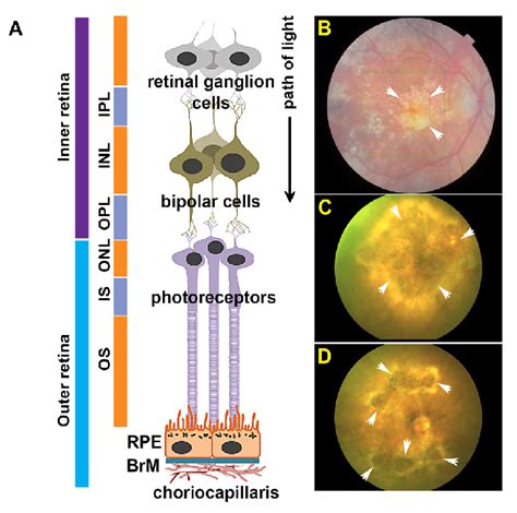 Anatomy Of The Retina And Funduscopy Showing Geographic Atrophy Ga