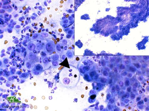 Dog Skin Cytology Fna Squamous Cell Carcinoma Case Gallery