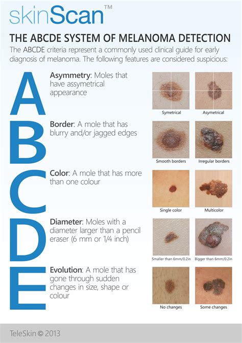 Pdf Evolving From The Abcdes Of Early Melanoma Detection A Case Hot