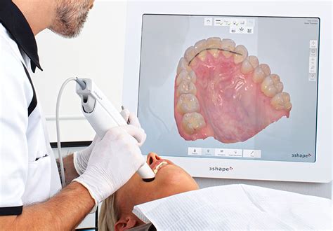 Intra Oral Scanner Starlight Dental Clinic