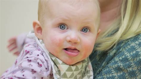 How To Prepare For A Baby With A Cleft Lip Or Palate University Of