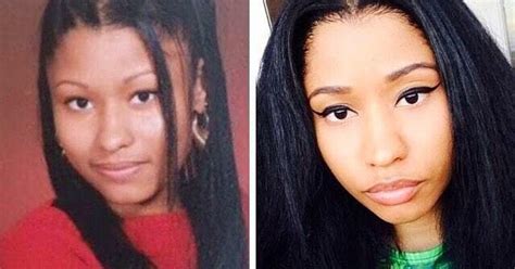 Unbelievable Transformation See Nicki Minaj At 17before Surgery And