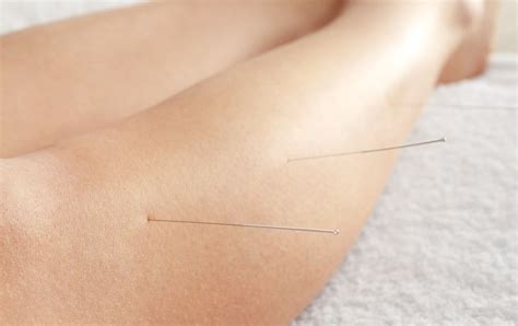 acupuncture increases dietary program successes for patients with obesity lower cholesterol