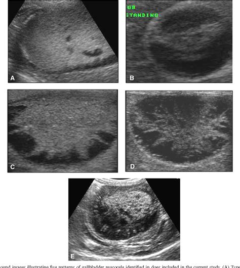 Figure 1 From Comparison Between Ultrasonographic And Clinical Findings