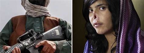 Afghan Woman Had Her Nose And Ears Chopped Off By The Taliban After