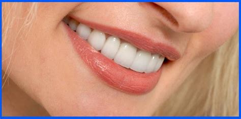 Teeth whitening was once a cosmetic process done only in the dentist's office. Porcelain Veneers : Famous Cosmetic Dental Treatment to ...