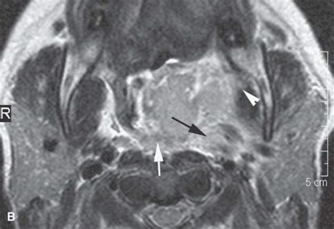 Infections And Noninfectious Inflammatory Disorders General Morphology