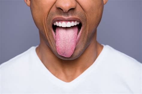 Enlarged Papillae Causes Symptoms And Treatment Oral Care