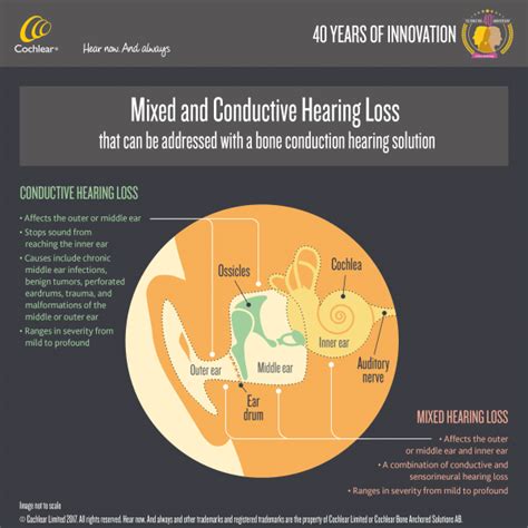 Looking For A Treatment For Conductive Hearing Loss